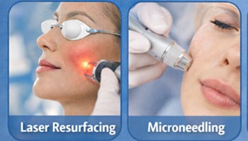 Terini yoshartirish uchun eng yaxshi muolaja nima