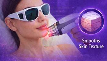 Terini lazer bilan qayta tiklash nima